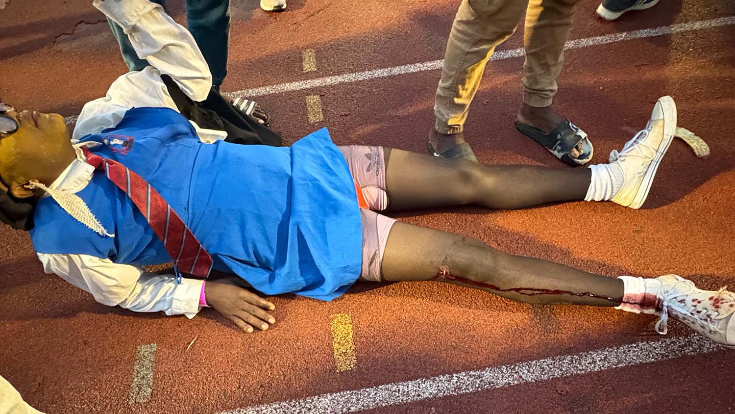 Police have explained the accidental shooting of Mbabane Highlanders’ super fan ‘Yellow Man’.